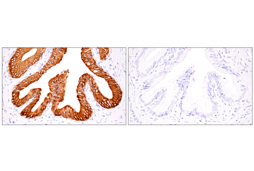 Immunohistochemistry Image 1: Keratin 7 (RN7) Mouse Monoclonal Antibody