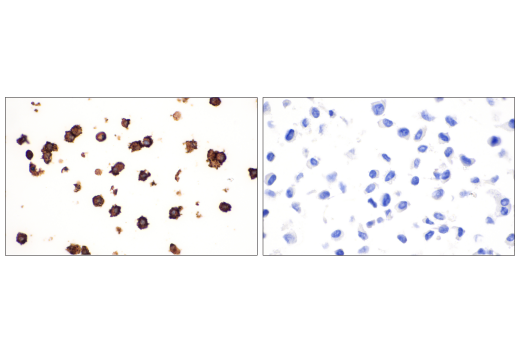 Immunohistochemistry Image 3: IL-2R alpha/CD25 (E9W2J) Rabbit Monoclonal Antibody