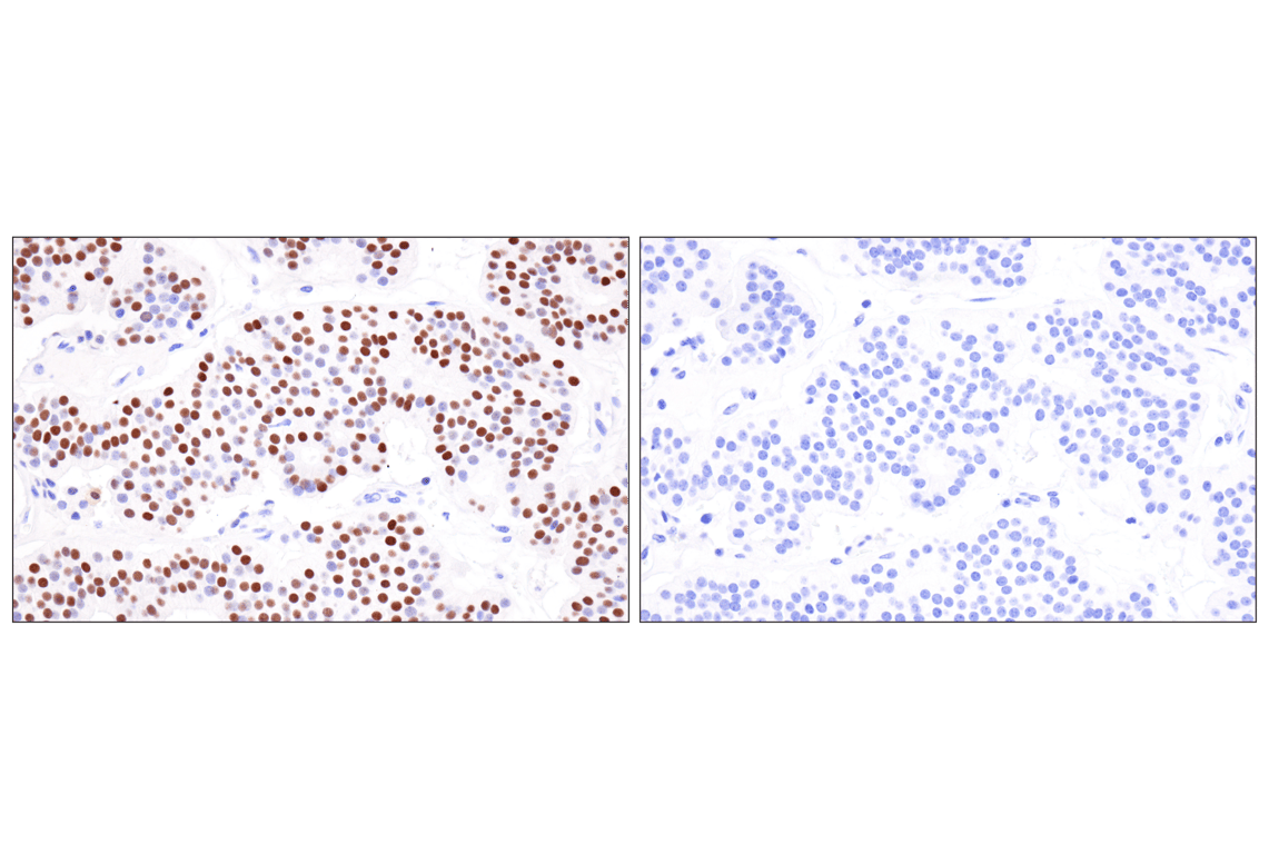 Immunohistochemistry Image 9: INSM1 (BLR272L) Rabbit Monoclonal Antibody