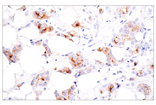 Immunohistochemistry Image 1: CD109 (E4I2V) Rabbit Monoclonal Antibody