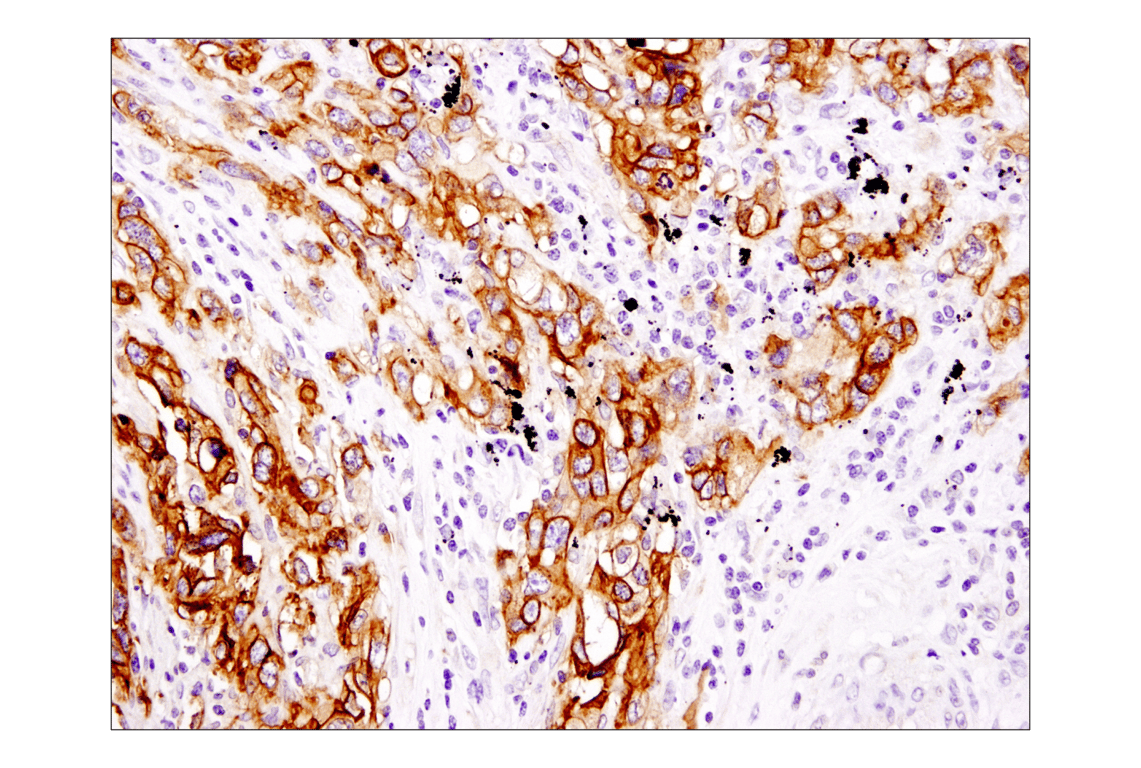 Immunohistochemistry Image 3: EpCAM (D9S3P) Rabbit Monoclonal Antibody