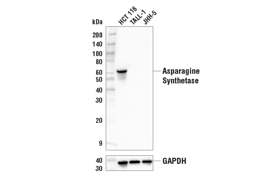Western Blotting Image 2: Asparagine Synthetase (E6C2C) Rabbit Monoclonal Antibody