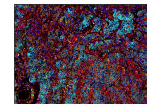 Immunohistochemistry Image 7: VISTA (D1L2G<sup>™</sup>) Rabbit Monoclonal Antibody (BSA and Azide Free)