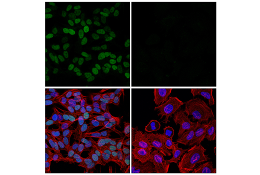 undefined Image 72: Epithelial-Mesenchymal Transition (EMT) IF Antibody Sampler Kit