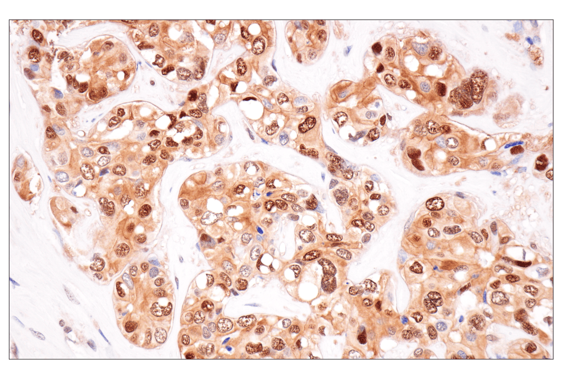 Immunohistochemistry Image 1: Phospho-ATP-Citrate Lyase (Ser455) (F4T8R) Rabbit Monoclonal Antibody