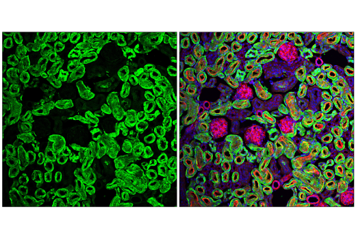 Immunofluorescence Image 2: NDRG1 (E2T5I) Rabbit Monoclonal Antibody