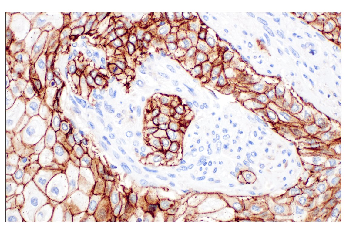 Immunohistochemistry Image 1: CD44 v6 (C44Mab-9) Mouse Monoclonal Antibody