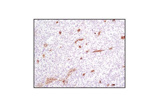 Immunohistochemistry Image 2: Caveolin-1 (D46G3) Rabbit Monoclonal Antibody