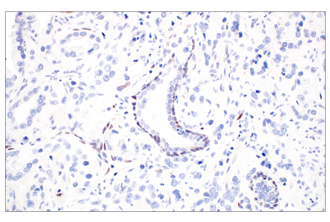 Immunohistochemistry Image 6: ARK5 (E4T2A) Rabbit Monoclonal Antibody