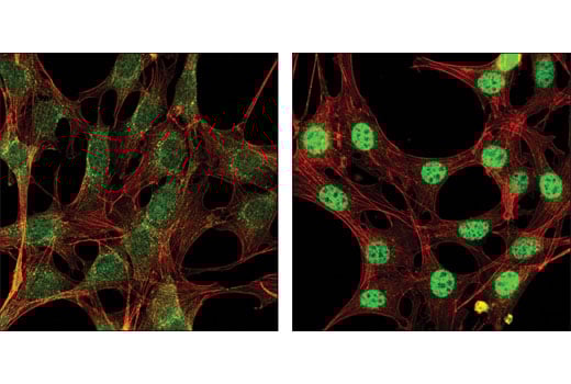 undefined Image 13: SMAD2/3 Antibody Sampler Kit