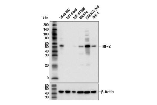 Western Blotting Image 1: IRF-2 (E9S1E) Rabbit mAb