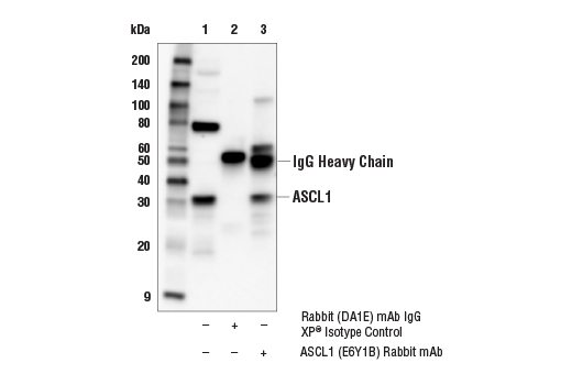 Immunoprecipitation Image 1: ASCL1 (E6Y1B) Rabbit Monoclonal Antibody