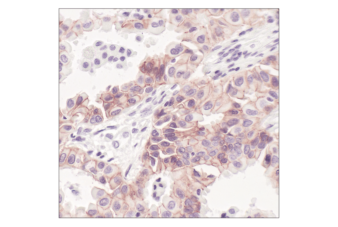 Immunohistochemistry Image 2: E-Cadherin (24E10) Rabbit Monoclonal Antibody
