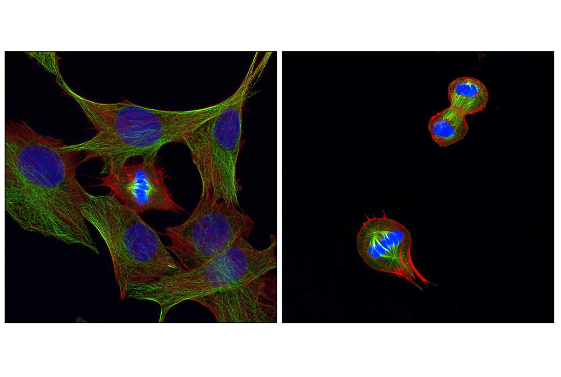 Immunofluorescence Image 1: beta-Tubulin (D3U1W) Mouse Monoclonal Antibody (BSA and Azide Free)