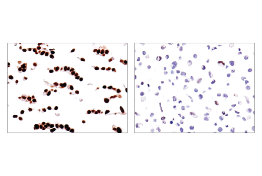 Immunohistochemistry Image 1: TEAD1 (D9X2L) Rabbit Monoclonal Antibody (BSA and Azide Free)