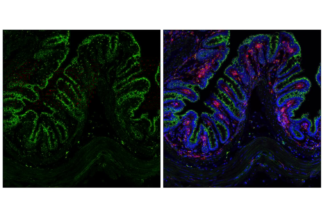 undefined Image 23: Genetics of Parkinson's Disease: Lysosomal Dysfunction Antibody Sampler Kit