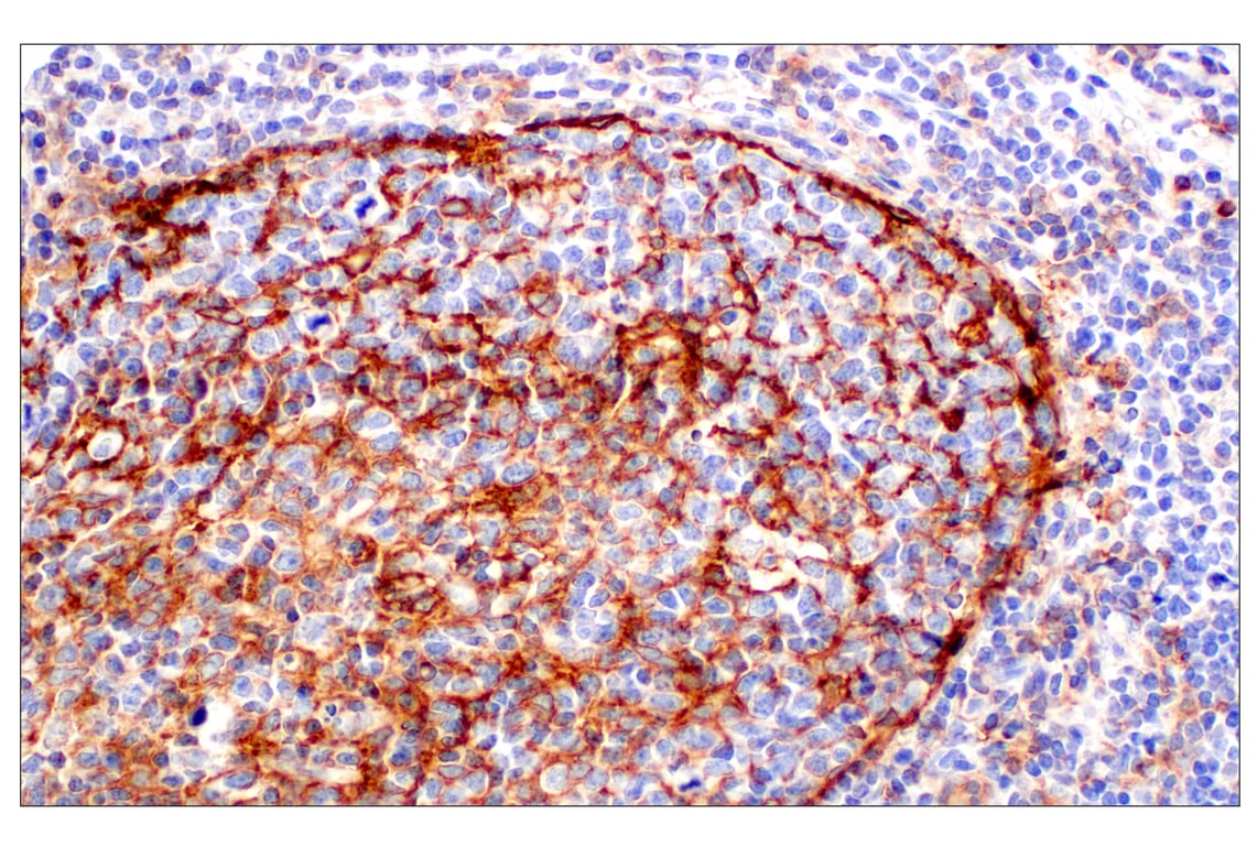 Immunohistochemistry Image 11: CD11b/ITGAM (E3J2F) Rabbit Monoclonal Antibody