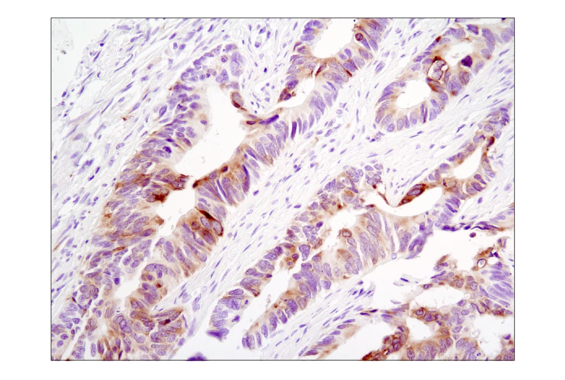 Immunohistochemistry Image 6: Phospho-S6 Ribosomal Protein (Ser235/236) (D57.2.2E) Rabbit Monoclonal Antibody (BSA and Azide Free)