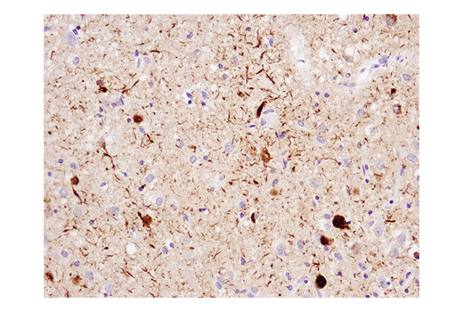 Immunohistochemistry Image 1: Phospho-Tau (Ser404) (D2Z4G) Rabbit Monoclonal Antibody (BSA and Azide Free)