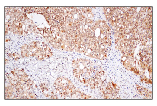 Immunohistochemistry Image 3: MGMT (E9O4V) Rabbit Monoclonal Antibody