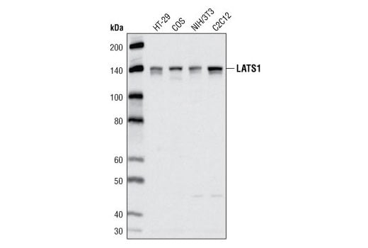 undefined Image 5: Hippo Signaling Antibody Sampler Kit