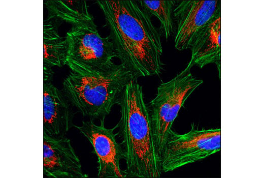 Immunofluorescence Image 1: COX IV (3E11) Rabbit mAb (Alexa Fluor<sup>®</sup> 555 Conjugate)