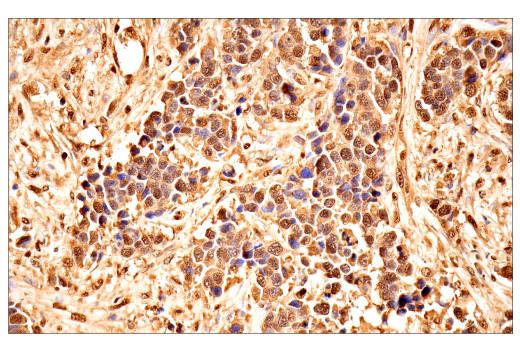 Immunohistochemistry Image 4: Ubiquitin (E6K4Y) Rabbit Monoclonal Antibody (BSA and Azide Free)