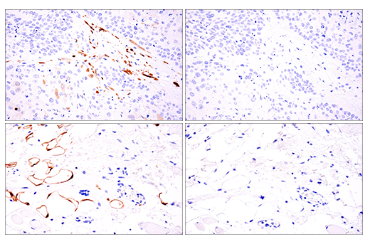 Immunohistochemistry Image 10: Calretinin (E7R6O) Rabbit Monoclonal Antibody