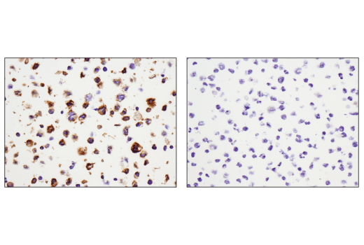 Immunohistochemistry Image 4: CD11c (D3V1E) XP<sup>®</sup> Rabbit mAb (BSA and Azide Free)