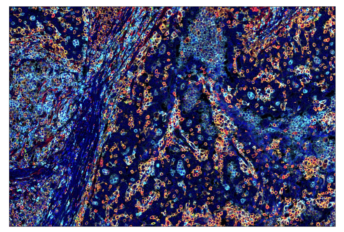 undefined Image 6: SignalStar<sup>™</sup> Midplex IHC Buffer Kit