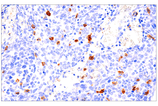 Immunohistochemistry Image 3: CD103/ITGAE (EP206) Rabbit Monoclonal Antibody