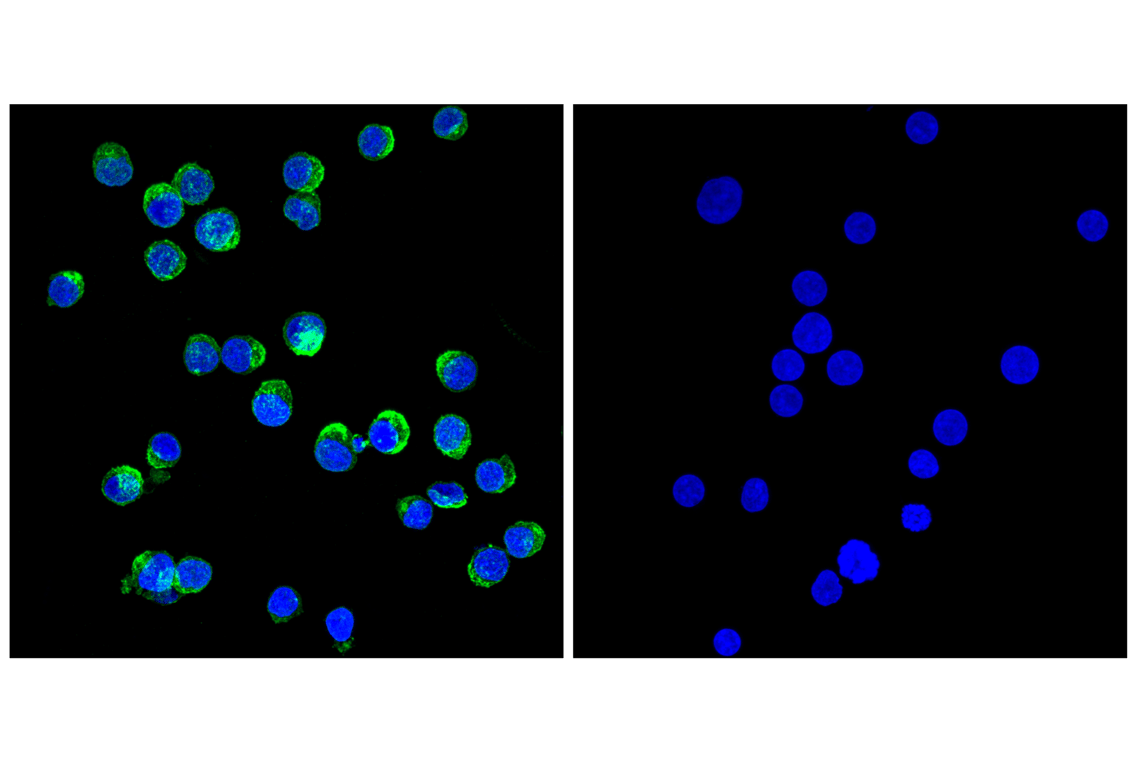 Immunofluorescence Image 1: CD79B (D7V2F) Rabbit Monoclonal Antibody