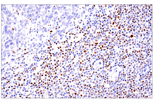 Immunohistochemistry Image 4: SATB1 (E5Z3U) Rabbit Monoclonal Antibody