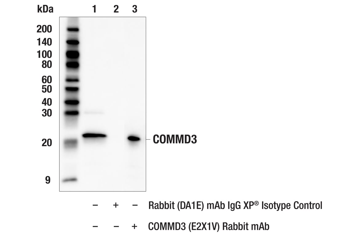 Immunoprecipitation Image 1: COMMD3 (E2X1V) Rabbit Monoclonal Antibody