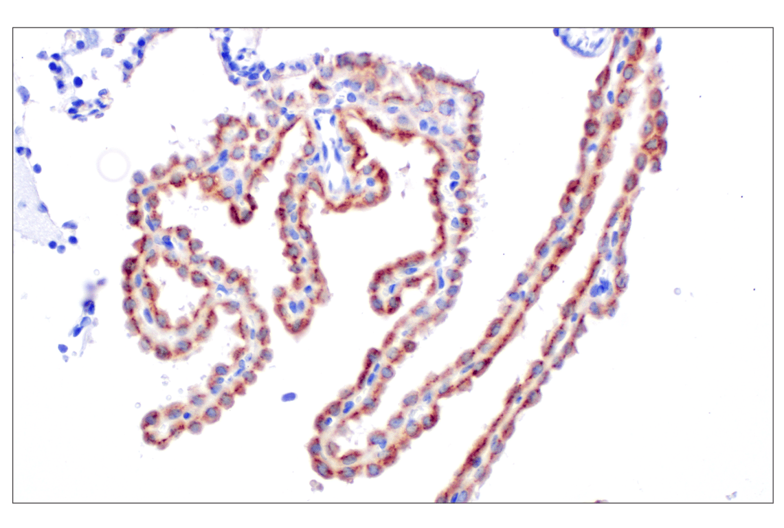 Immunohistochemistry Image 5: IGFBP2 (F3E6V) Rabbit Monoclonal Antibody