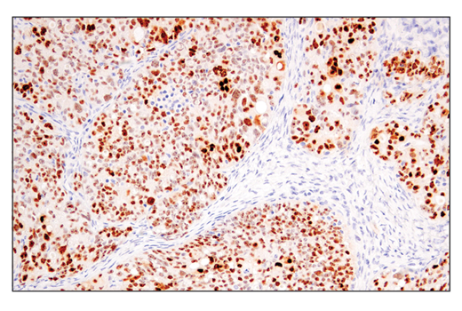 Immunohistochemistry Image 3: p14 ARF (E3X6D) Rabbit Monoclonal Antibody