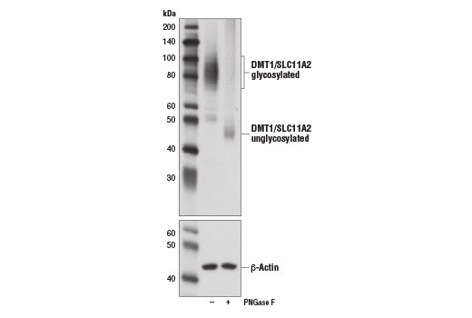 Western Blotting Image 2: DMT1/SLC11A2 (D3V8G) Rabbit Monoclonal Antibody