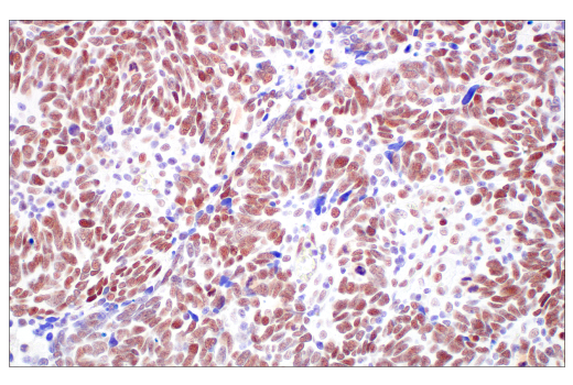 Immunohistochemistry Image 7: TIF1 alpha/TRIM24 (E9T3N) Rabbit Monoclonal Antibody