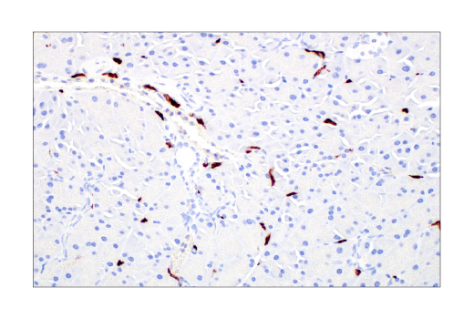 Immunohistochemistry Image 6: CD206/MRC1 (E6T5J) Rabbit Monoclonal Antibody