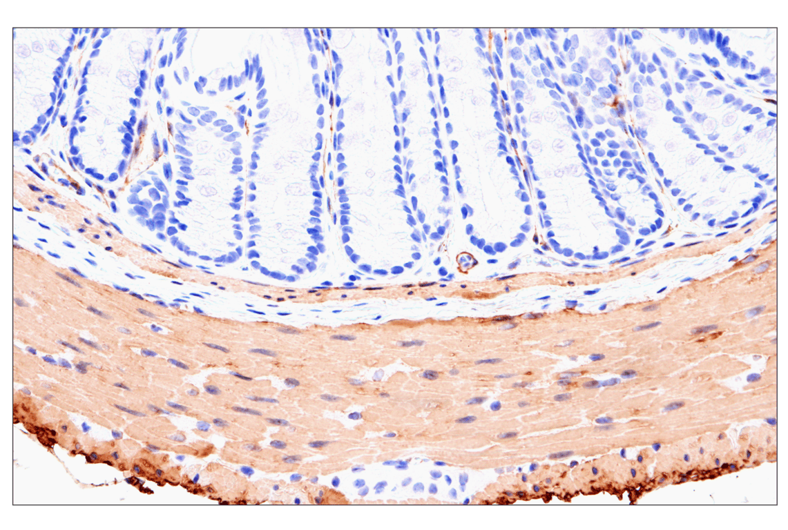 Immunohistochemistry Image 9: MYH11 (E4N8M) Rabbit Monoclonal Antibody (BSA and Azide Free)