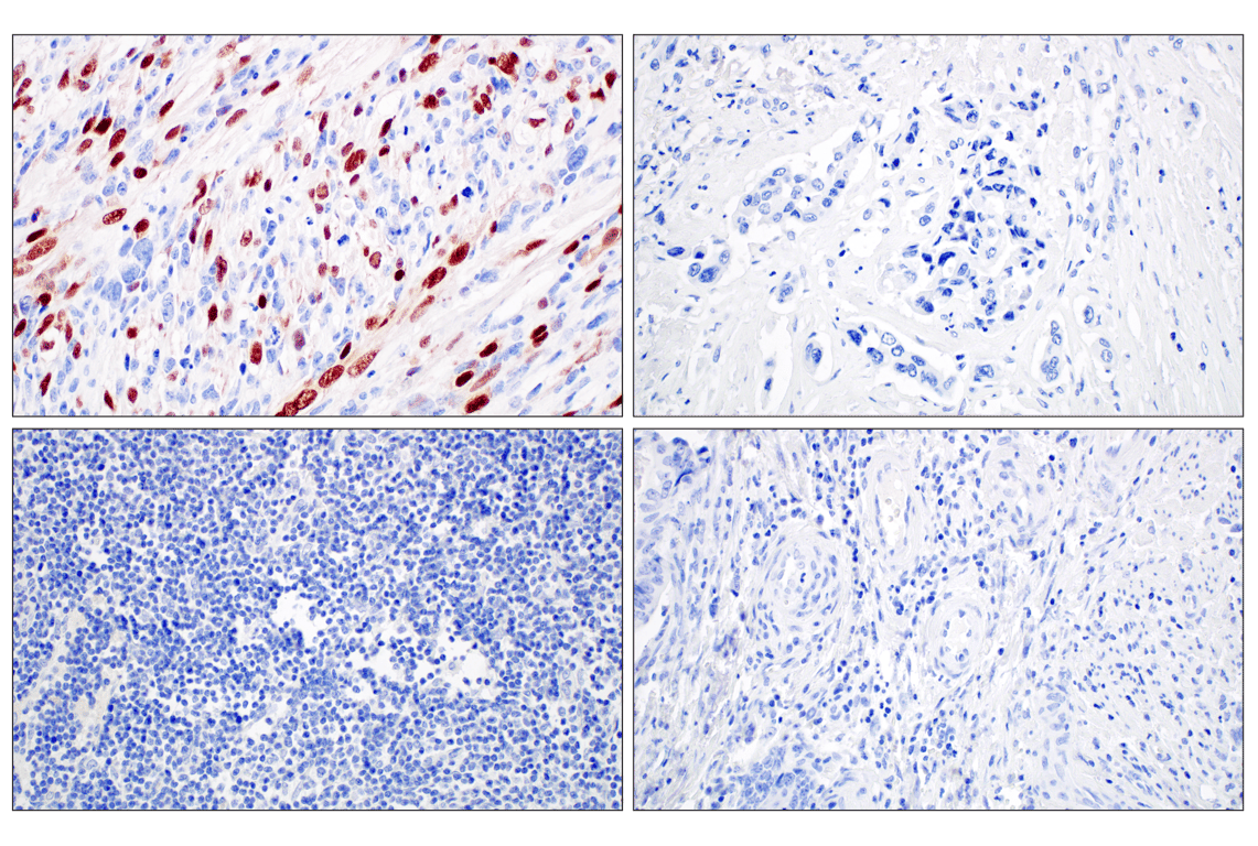 Immunohistochemistry Image 3: Myogenin (E9A1S) Rabbit Monoclonal Antibody