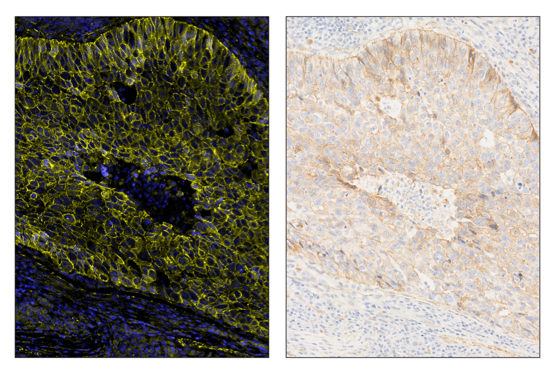 Immunohistochemistry Image 5: beta-Catenin (D10A8) & CO-0108-750 SignalStar<sup>™</sup> Oligo-Antibody Pair