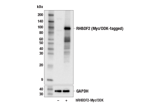 Western Blotting Image 2: RHBDF2 (E7U2K) Rabbit Monoclonal Antibody