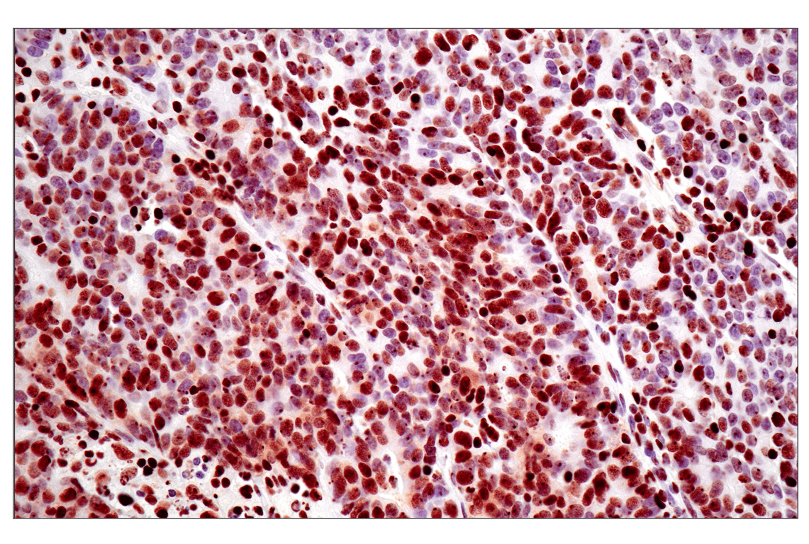 Immunohistochemistry Image 1: Tri-Methyl-Histone H3 (Lys27) (C36B11) Rabbit Monoclonal Antibody
