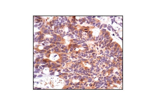 Immunohistochemistry Image 2: Phospho-cdc25C (Ser216) (63F9) Rabbit Monoclonal Antibody