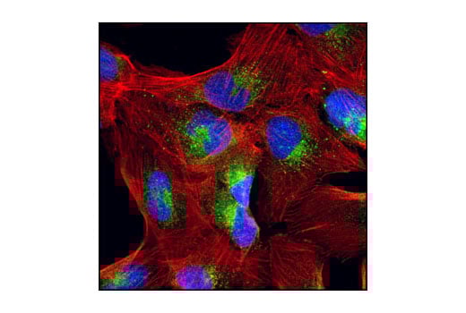 Immunofluorescence Image 1: TRAIL (C92B9) Rabbit Monoclonal Antibody (BSA and Azide Free)