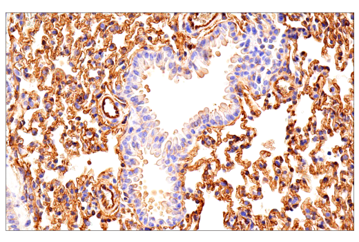 Immunohistochemistry Image 2: Crry (E9F1S) Rabbit Monoclonal Antibody