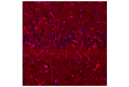 Immunofluorescence Image 1: Calpain 2 Large Subunit (M-type) (E3M6E) Rabbit Monoclonal Antibody (BSA and Azide Free)