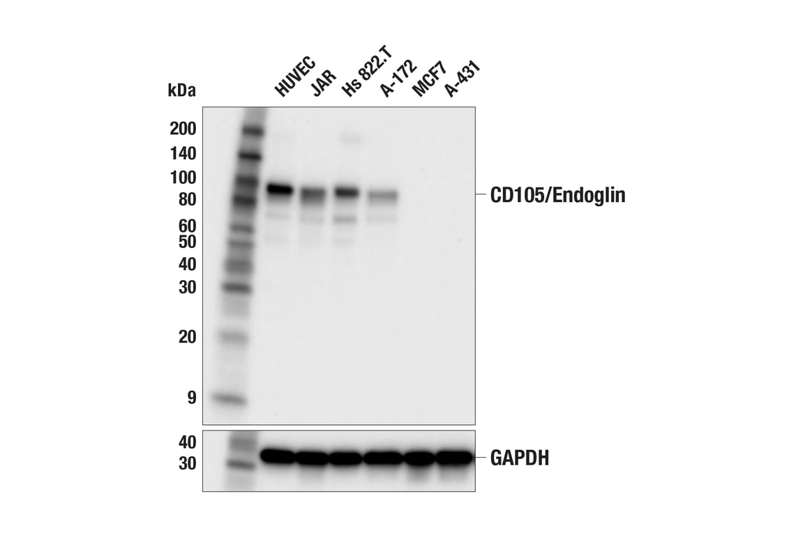 Western Blotting Image 2: CD105/Endoglin (F9C5Q) Rabbit Monoclonal Antibody (BSA and Azide Free)
