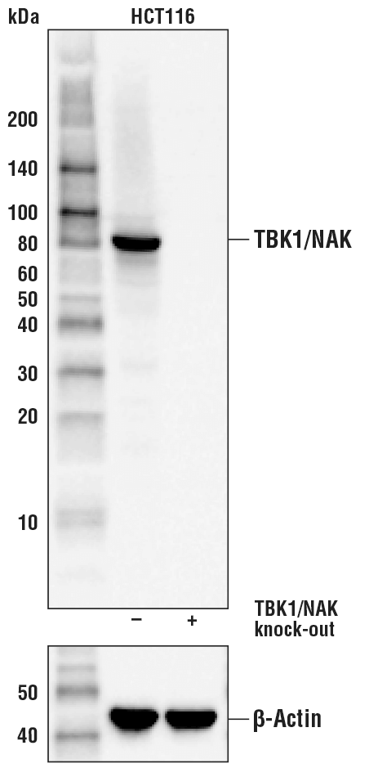Western Blotting Image 2: TBK1/NAK (E9H5S) Mouse Monoclonal Antibody